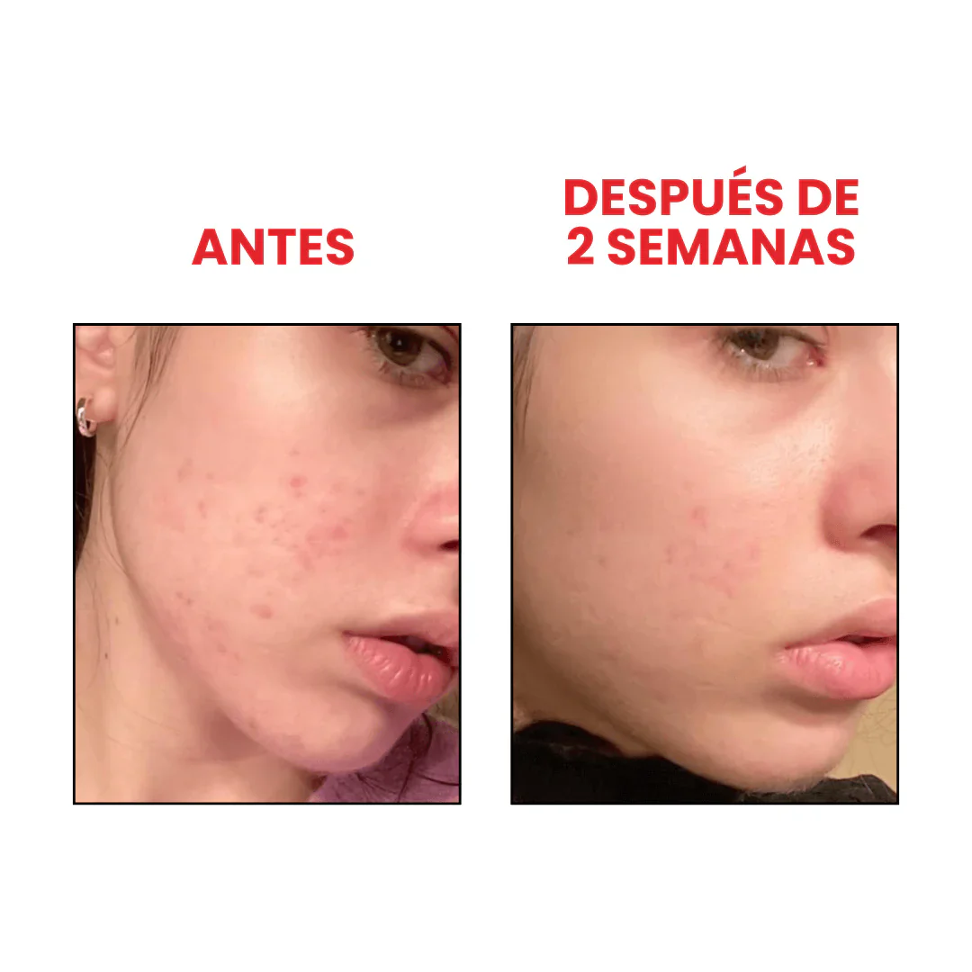 ANUA - Niacinamide 10% + TXA 4% Serum 30ml
